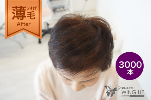 施術例その1（施術後）