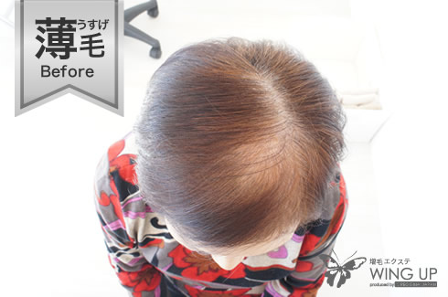 施術例その1（施術前）