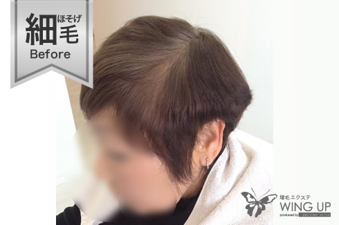 施術例その2（施術前）