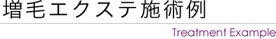 増毛エクステ施術例